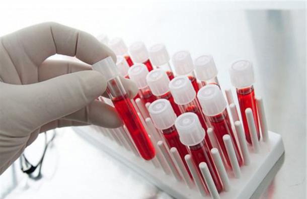 HIV testlerinin yorumlanması