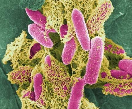 Staphylococcus aureus nasıl 