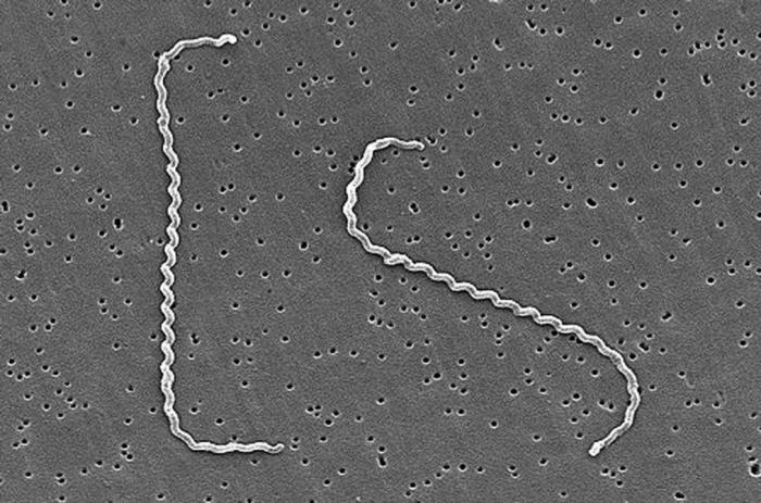 İnsan semptomlarında Leptospirosis