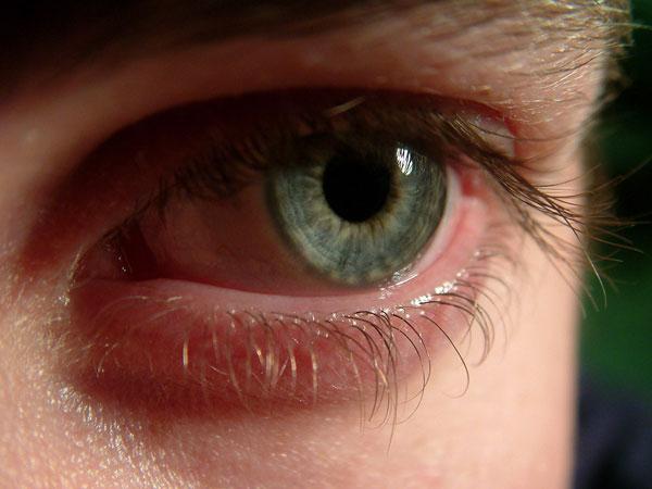 Gözler neden kırmızı ve rahatsızlığı gidermek için?